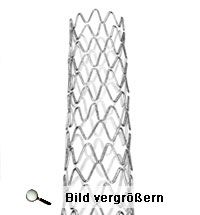 Ein implantiertes CRT-Gerät